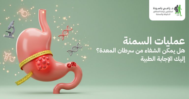 عمليات السمنة: هل يمكن الشفاء من سرطان المعدة؟ إليك الإجابة الطبية