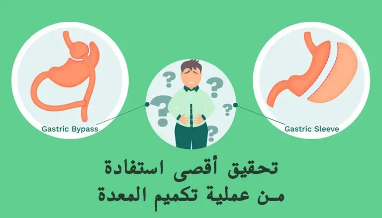 كيفية تحقيق أقصى استفادة من عملية تكميم المعدة