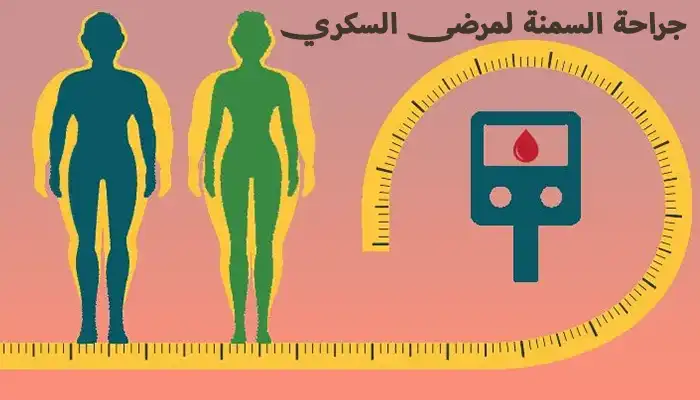 جراحة السمنة لمرضى السكري: كيف تساهم في تحسين الصحة العامة؟
