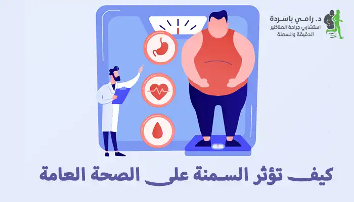 كيف تؤثر السمنة على الصحة العامة وكيف تعالج جراحيًا؟