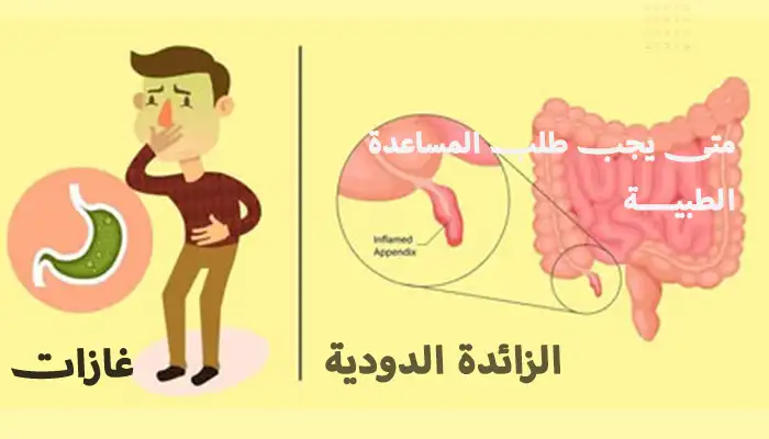 الفرق بين غازات البطن والتهاب الزائدة الدودية