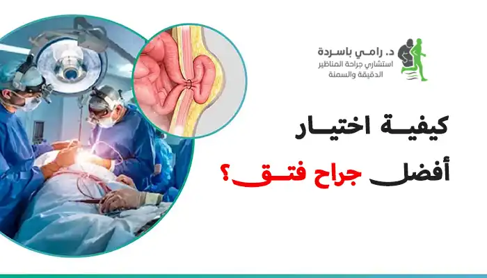 كيفية اختيار أفضل جراح فتق؟