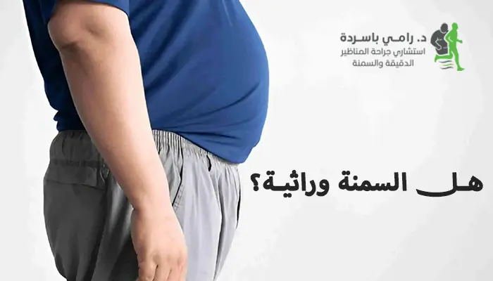 هل السمنة وراثية؟