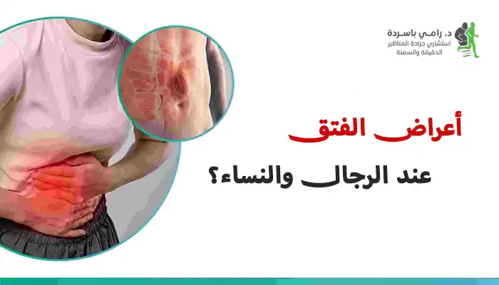 هل تختلف أعراض الفتق عند الرجال والنساء؟