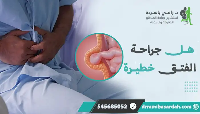 هل جراحة الفتق خطيرة؟