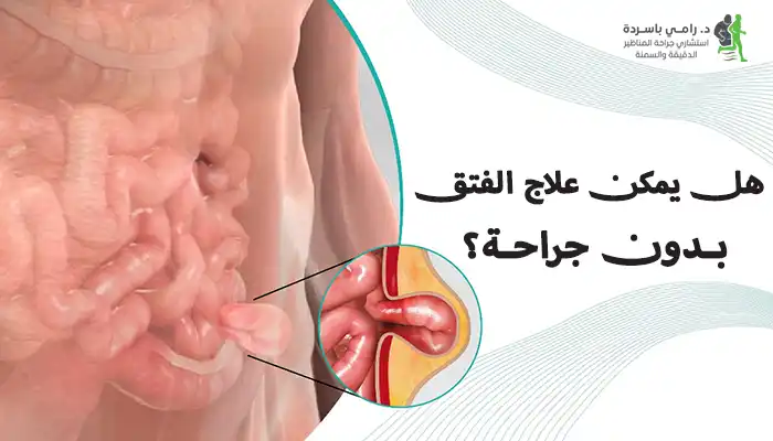 هل يمكن علاج الفتق بدون جراحة؟