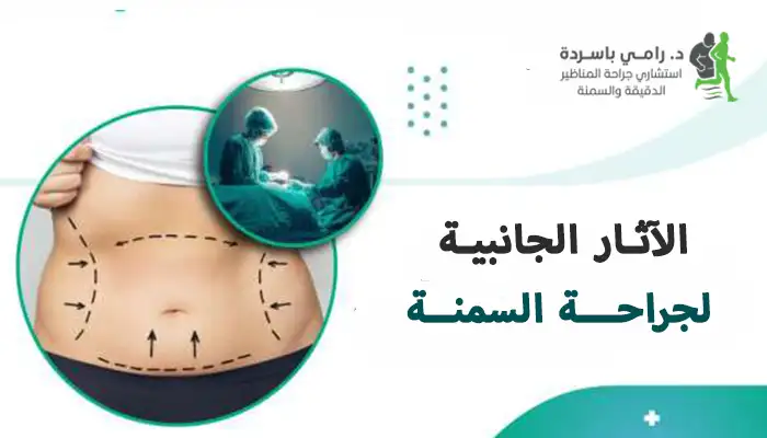الآثار الجانبية لجراحة السمنة