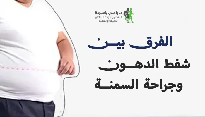 الفرق بين شفط الدهون وجراحة السمنة