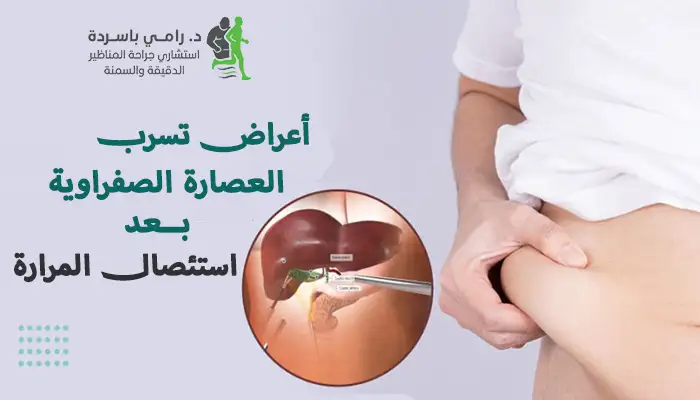 أعراض تسرب العصارة الصفراوية بعد استئصال المرارة