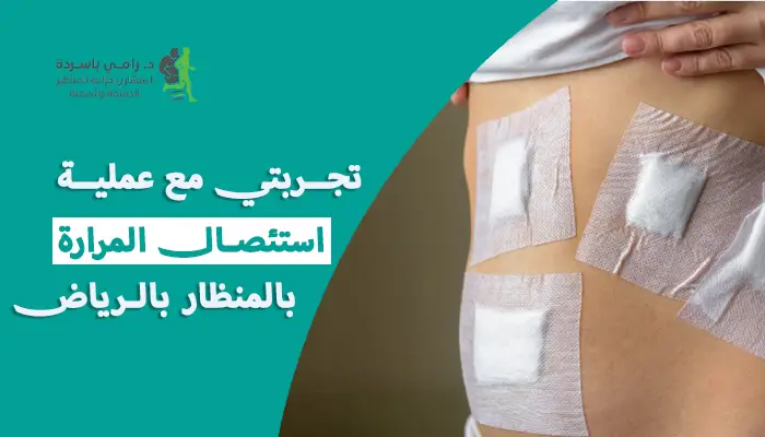 تجربتي بعد استئصال المرارة بالمنظار في الرياض