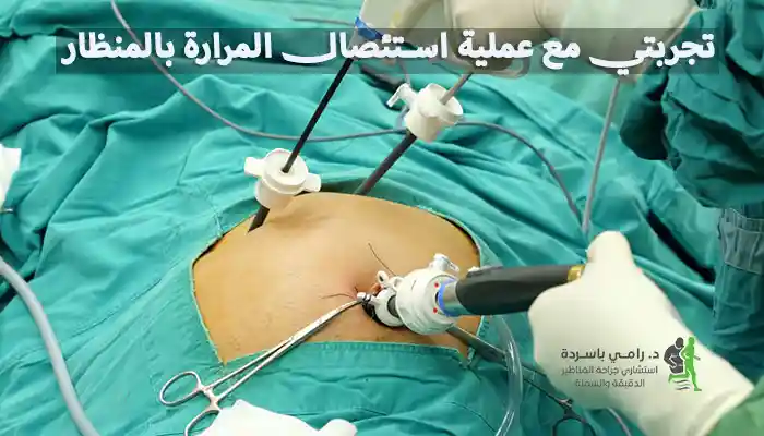 تجربتي مع عملية استئصال المرارة بالمنظار