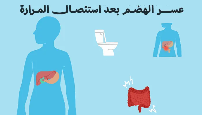 عسر الهضم بعد استئصال المرارة
