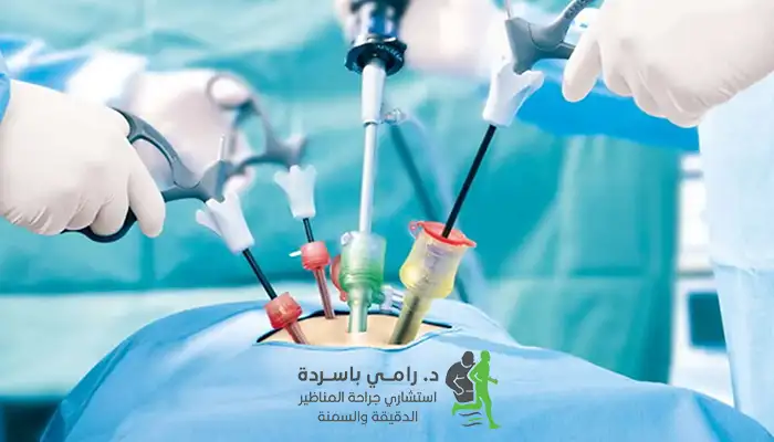 أفضل عيادة بالرياض لإستئصال المرارة بالمنظار