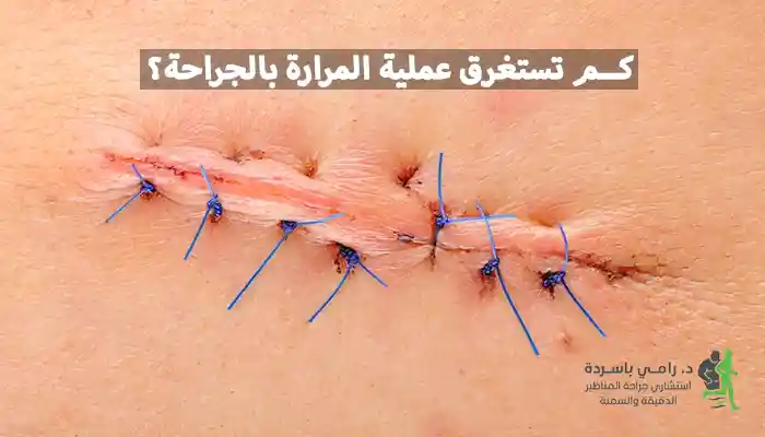 كم تستغرق عملية المرارة بالجراحة؟