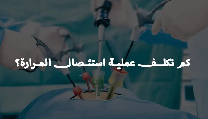 كم تكلف عملية استئصال المرارة؟