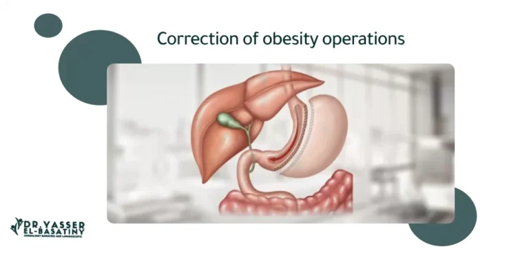 تصحيح عمليات السمنة في الرياض