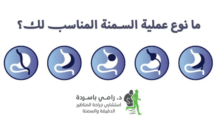 ما نوع عملية السمنة المناسب لك؟