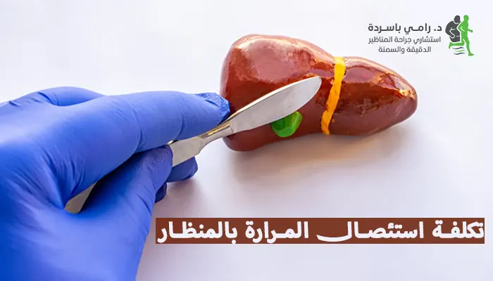 تكلفة استئصال المرارة بالمنظار