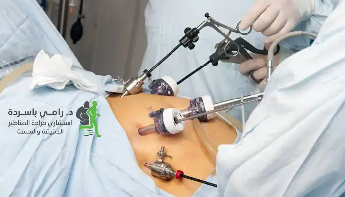 جراحة المرارة بالمنظار