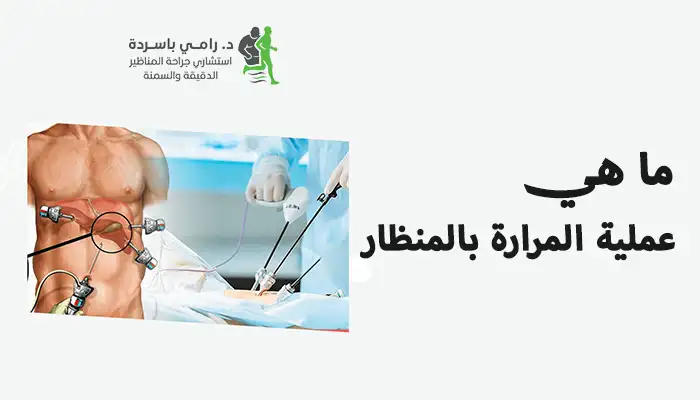 ما هي عملية المرارة بالمنظار، وكيف تتم؟