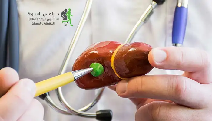 مدة عملية استئصال المرارة