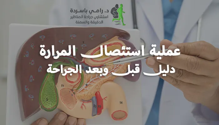 عملية استئصال المرارة: دليل قبل وبعد الجراحة