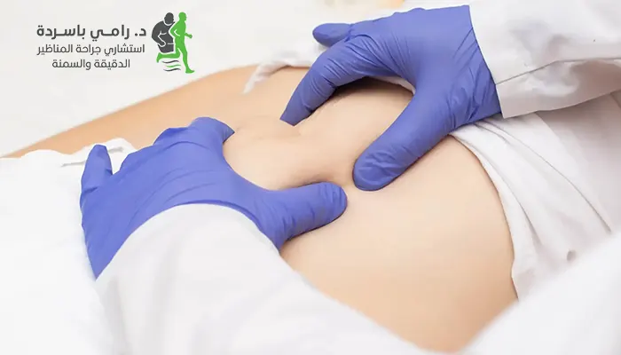 متى يلزم إجراء عملية الفتق؟