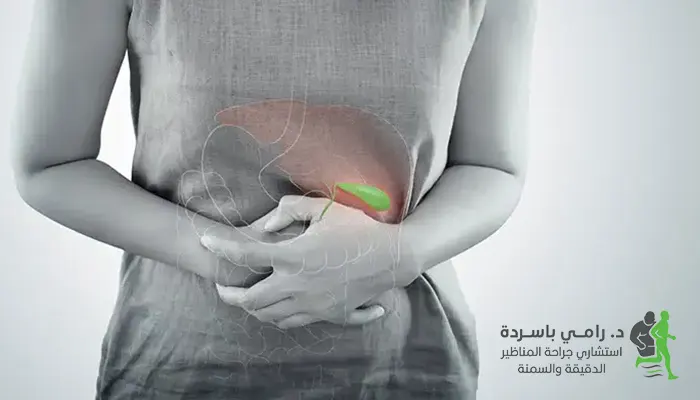 متى يلزم استئصال المرارة؟