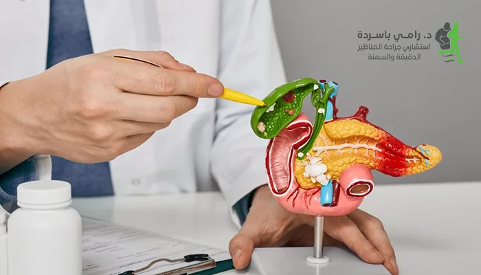 المرارة ومشاكلها متى يلزم استئصالها؟