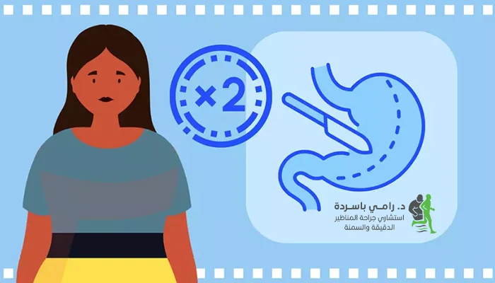 متى نحتاج إلى إعادة عملية تكميم المعدة؟