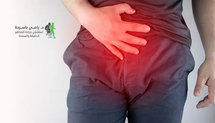 الفرق بين الفتق الإربي وفتق البطن