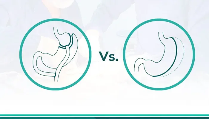 ما الفرق بين تحويل المسار والتكميم؟