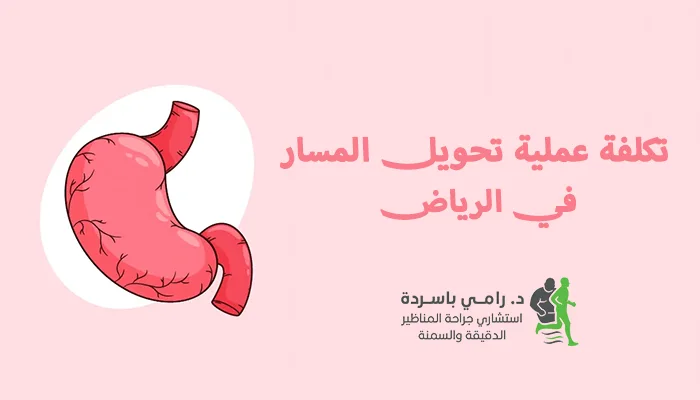 تكلفة عملية تحويل المسار في الرياض